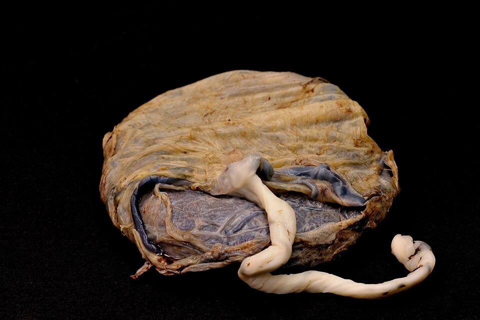 Pakistan Probes Multi-Country Human Placenta Trafficking Operation