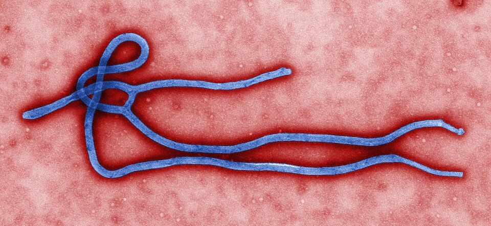 Deadly Ebola Outbreak Grips DR Congo Amid Rising Death Toll